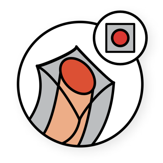 2-х компонентный материал, сечение витой квадрат